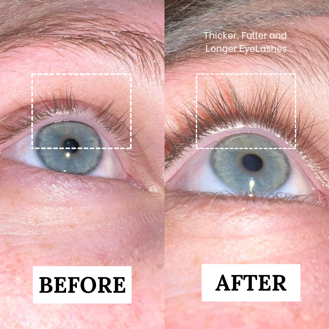 Lash Serum