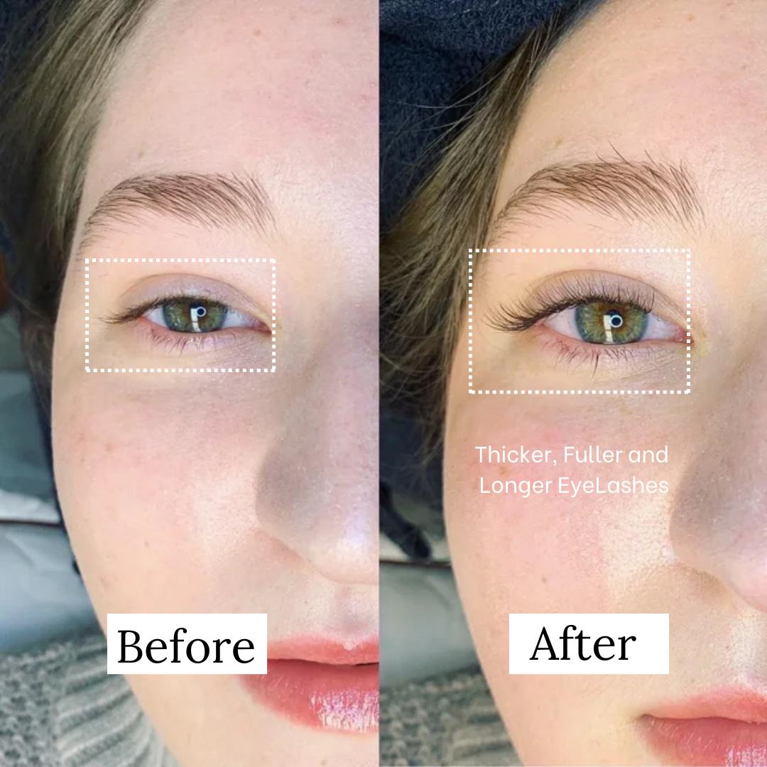 Lash Serum