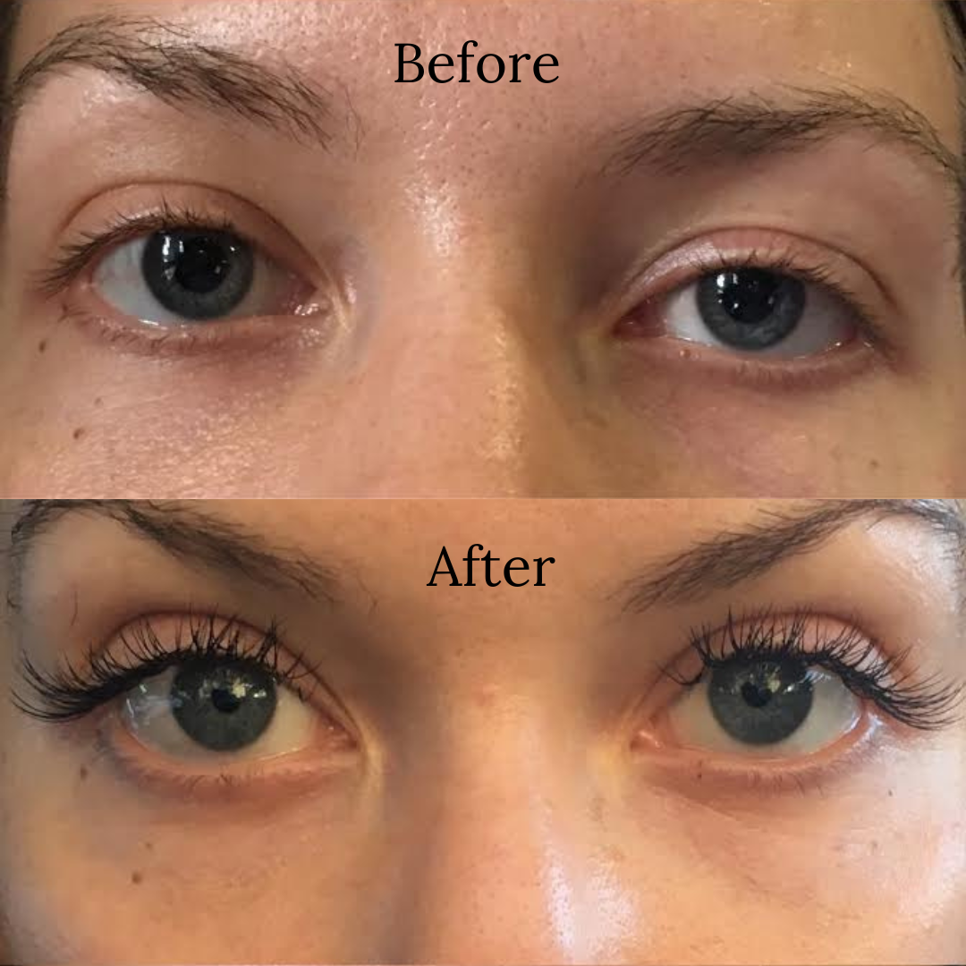 Lash Serum
